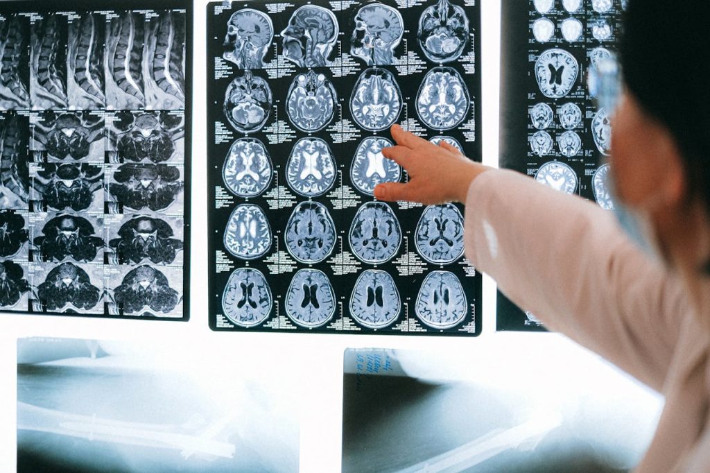 Mastering the First Impression: Your intriguing post title goes here Radiologist pointing at brain MRI scans showing detailed medical examination.